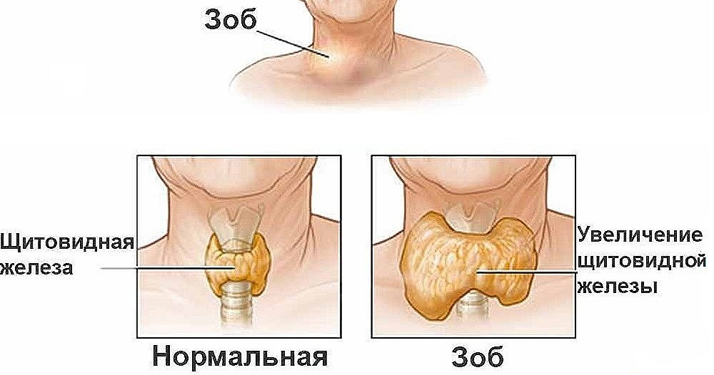 анализ крови на гормоны щитовидной железы